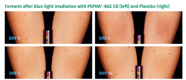 Étude comparative avant/après traitement cosmétique sur peau, évolution sur 10 jours avec ingrédient PEPHA-AGE